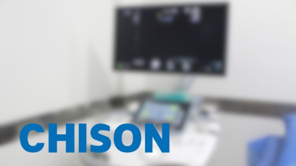 Chison Ultrasonidos