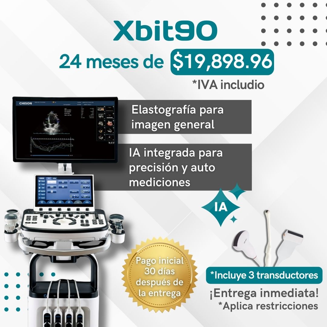 Xbit90