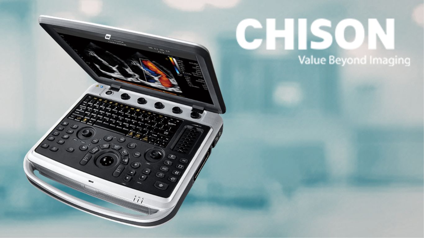 USG portatil Chison