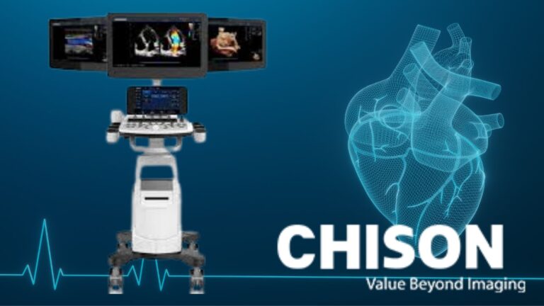 Ultrasonido para cardiología
